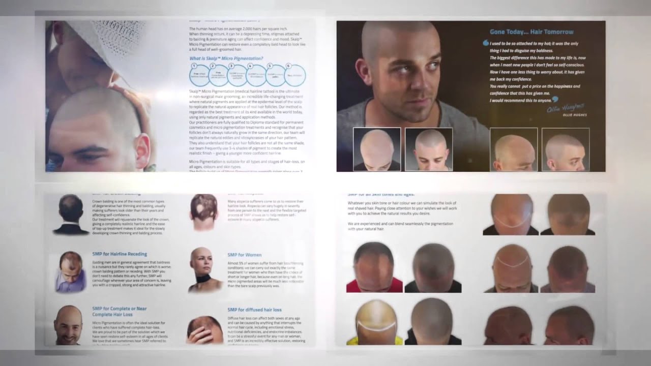 SKALP UK: Mike's Video Testimonial