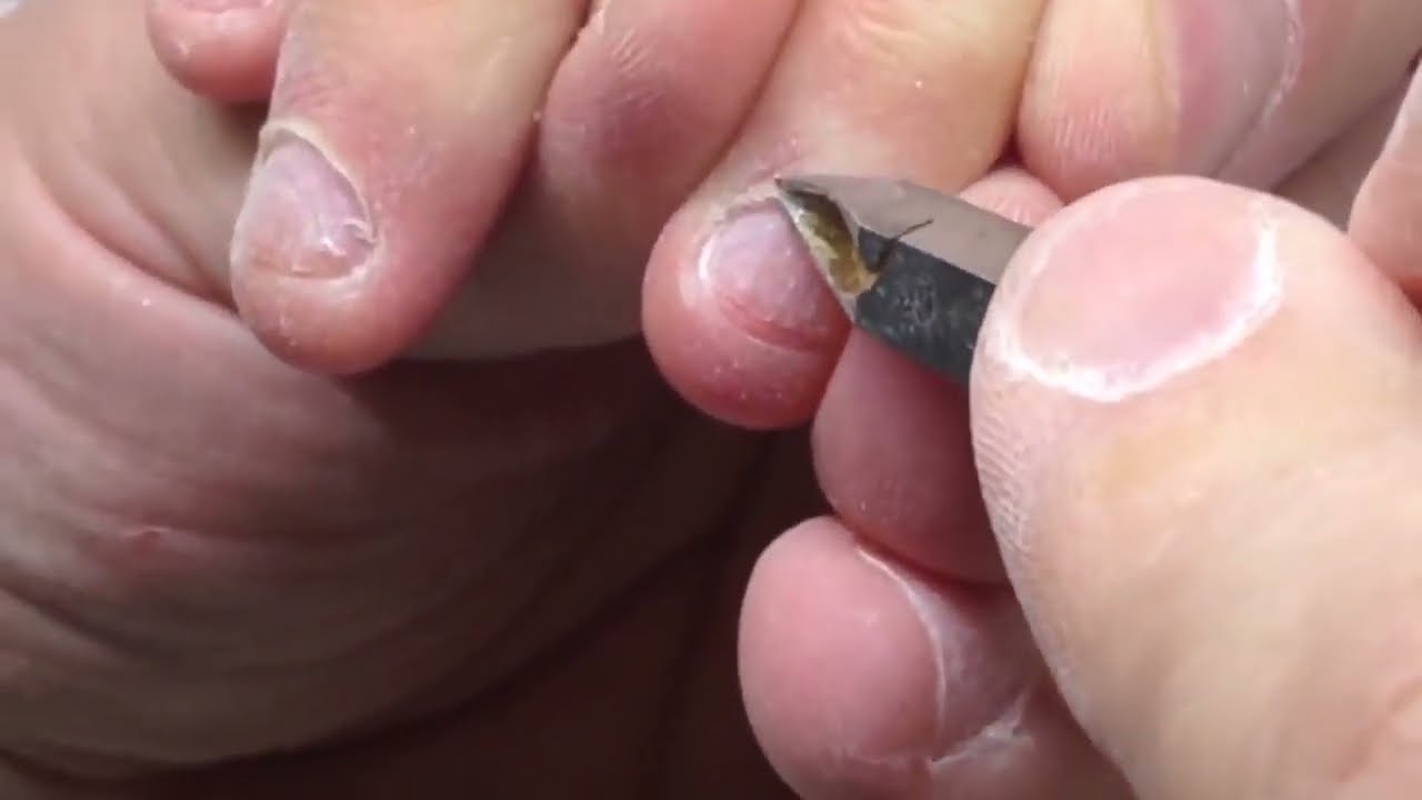 Cat Claw Stilletose DIY Tutorial Bitten Nails Transformation