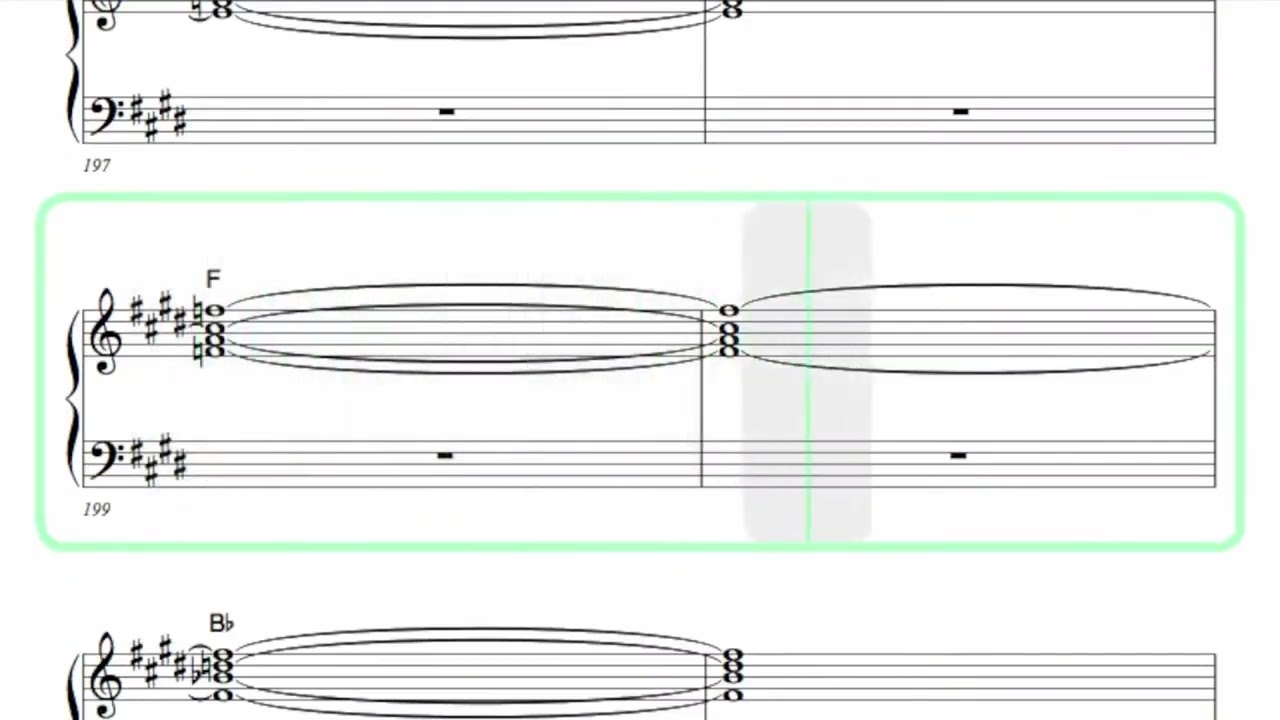 YES ● Starship Trooper [ Isolated Keyboard 1 + SCORE ]