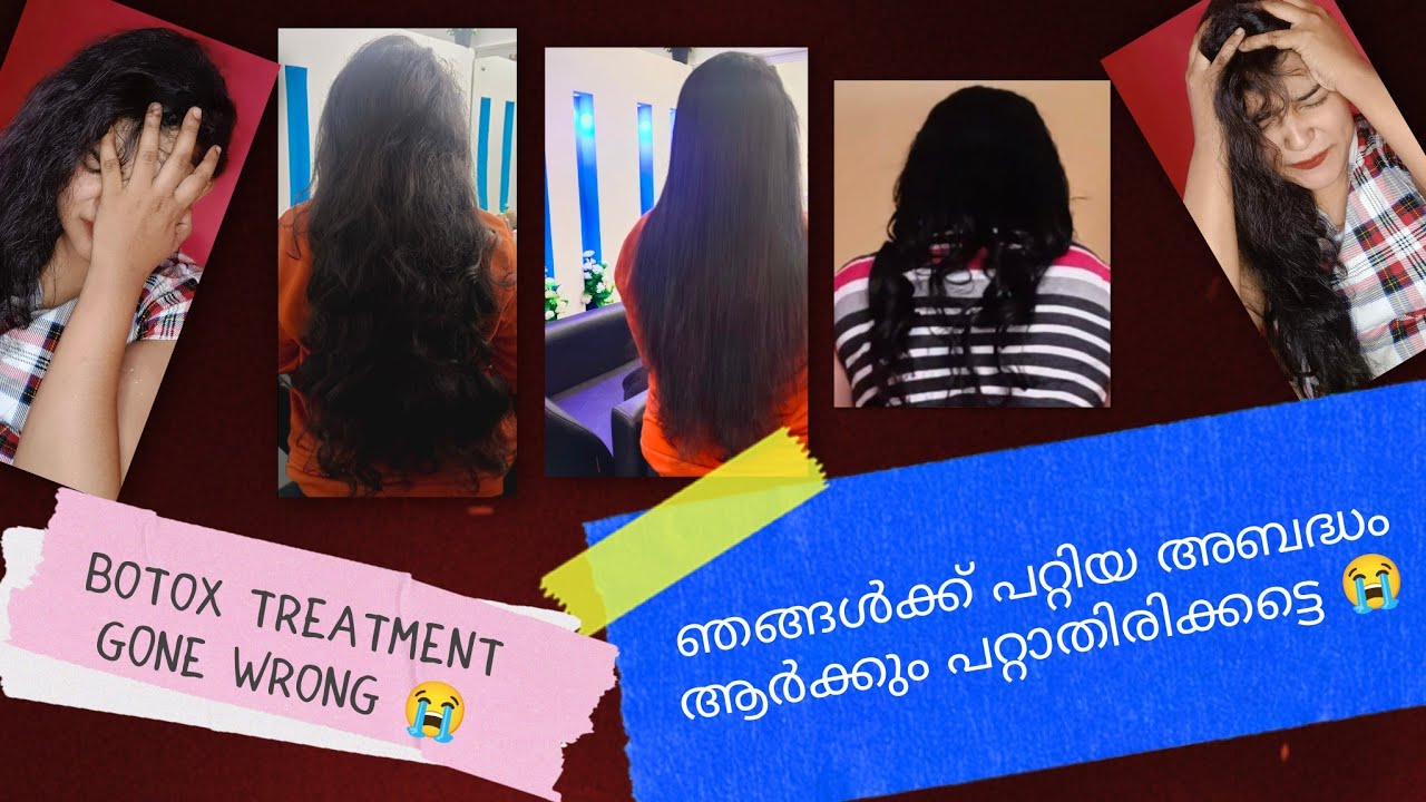 WORST EFFECT OF BOTOX TREATMENT | ഞങ്ങൾ അനുഭവിച്ചത്... SIGSUG FAM
