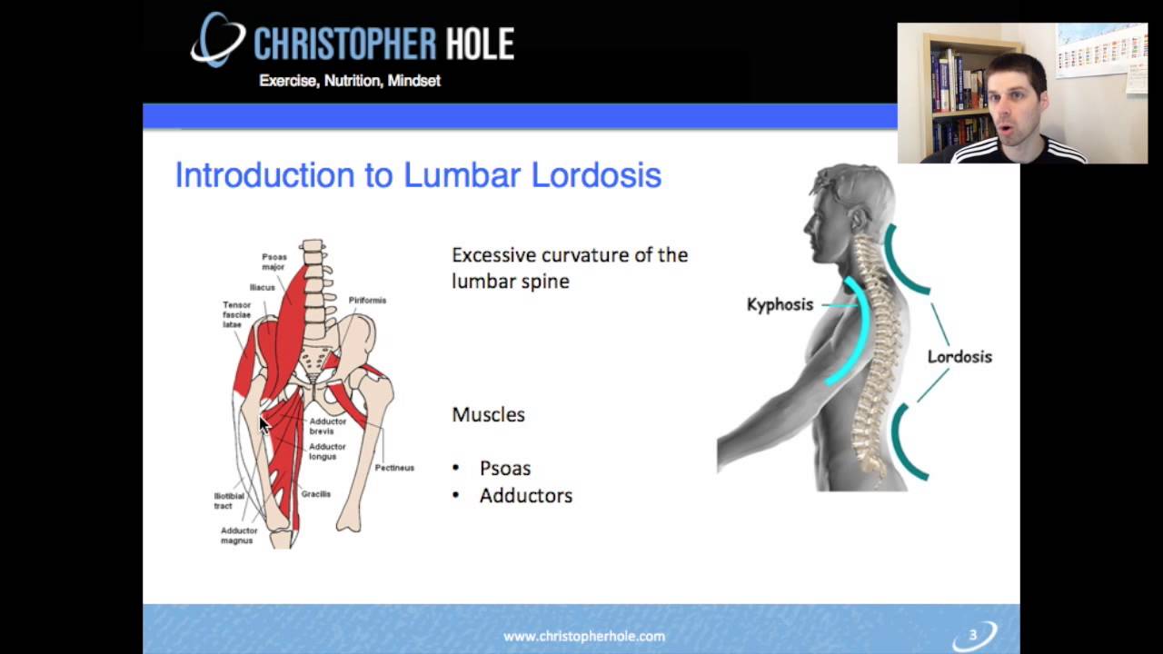 An Introduction to Lumbar Lordosis