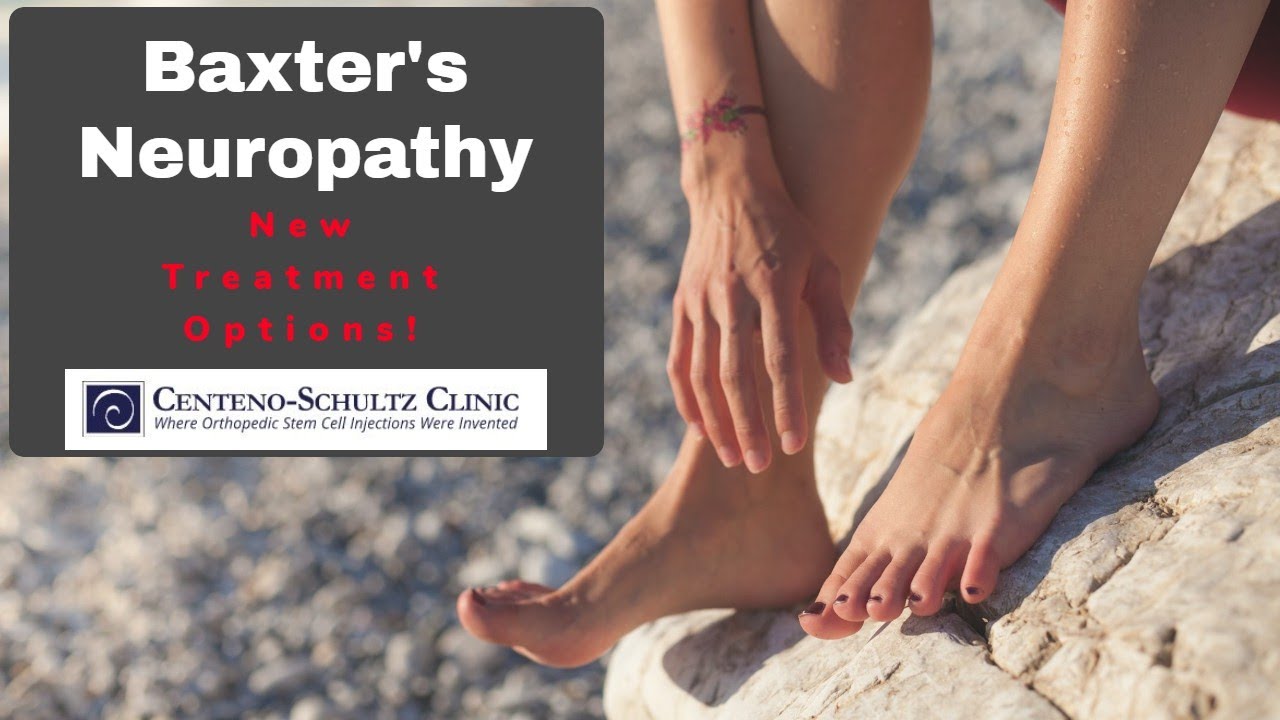 Baxters Neuropathy