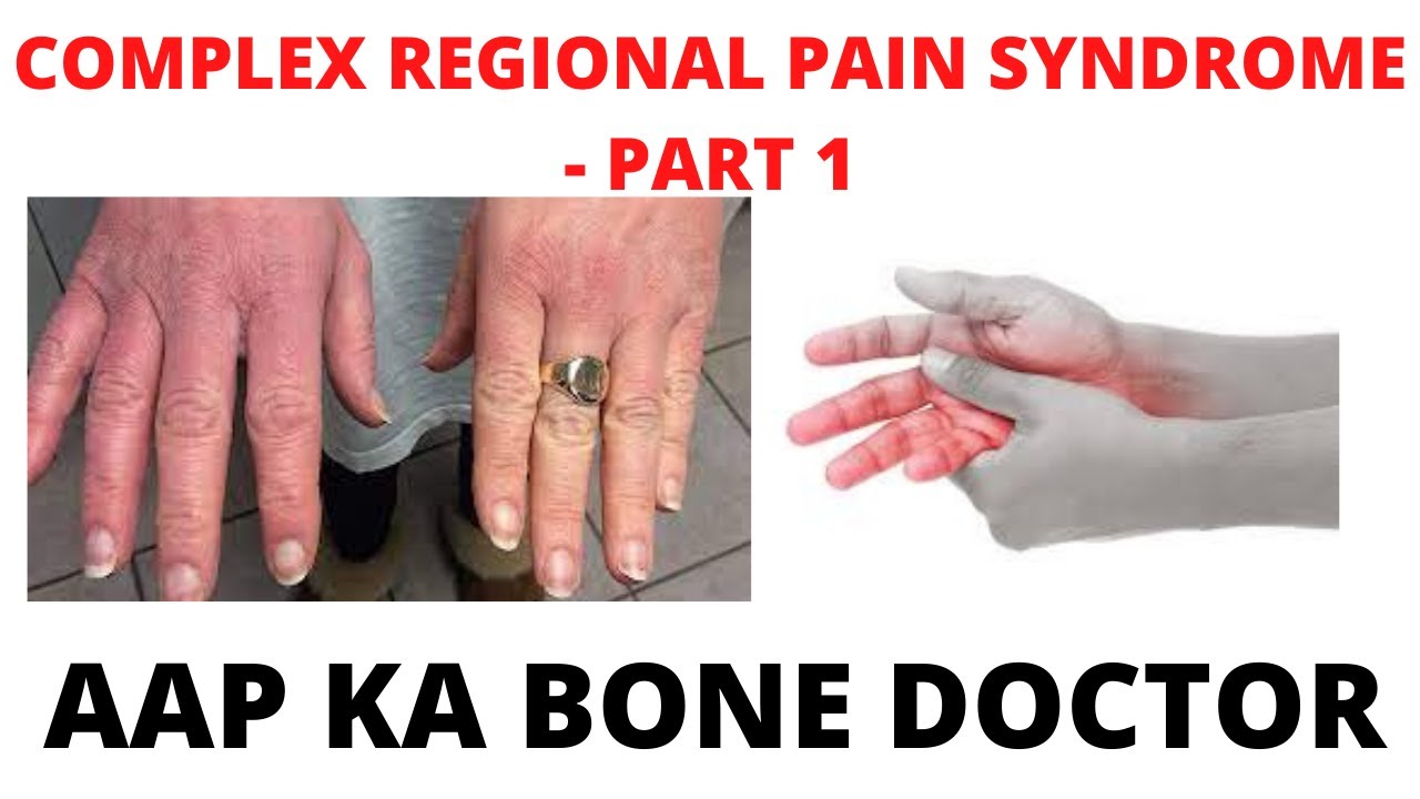 COMPLEX REGIONAL PAIN SYNDROME - PART 1 - EPISODE 46