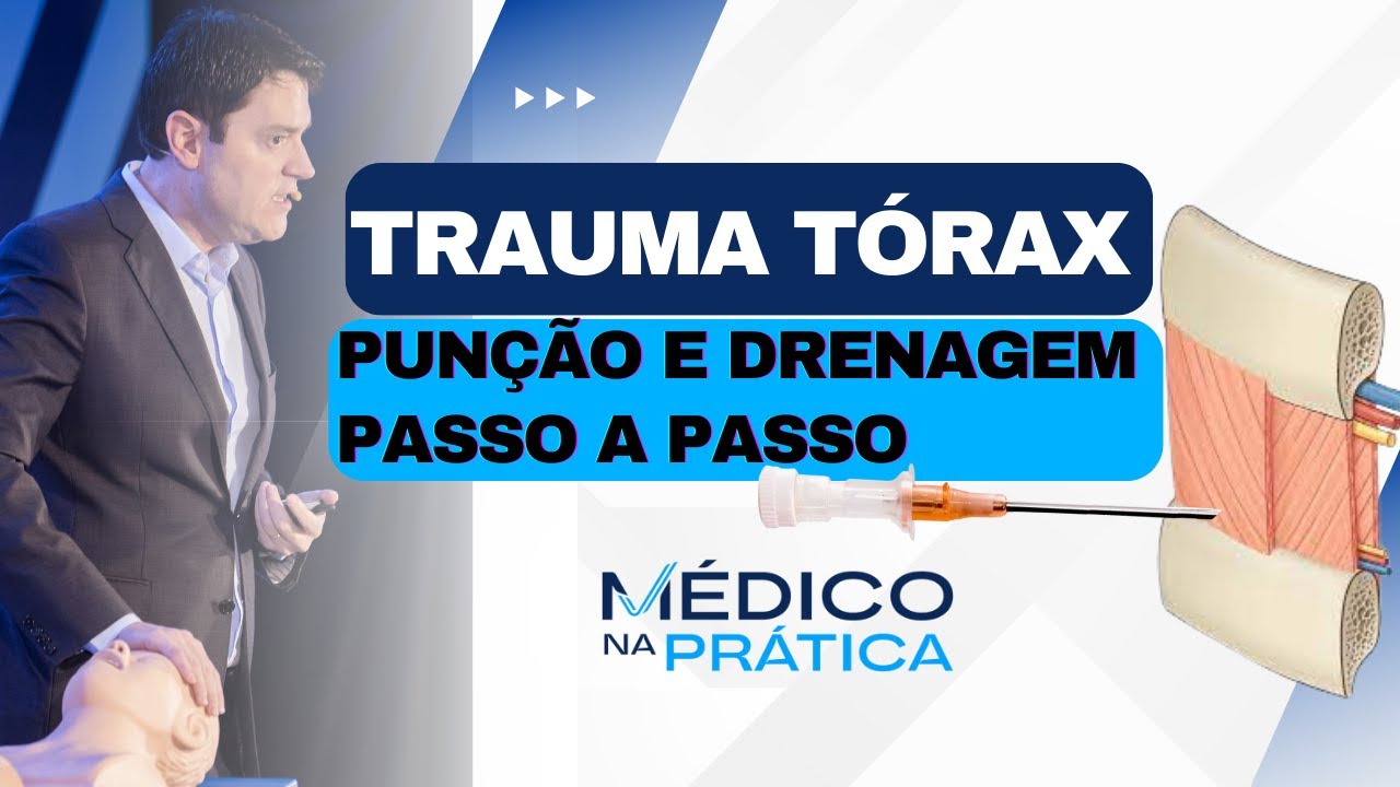 Pneumotórax hipertensivo na emergência | punção e dreno passo a passo
