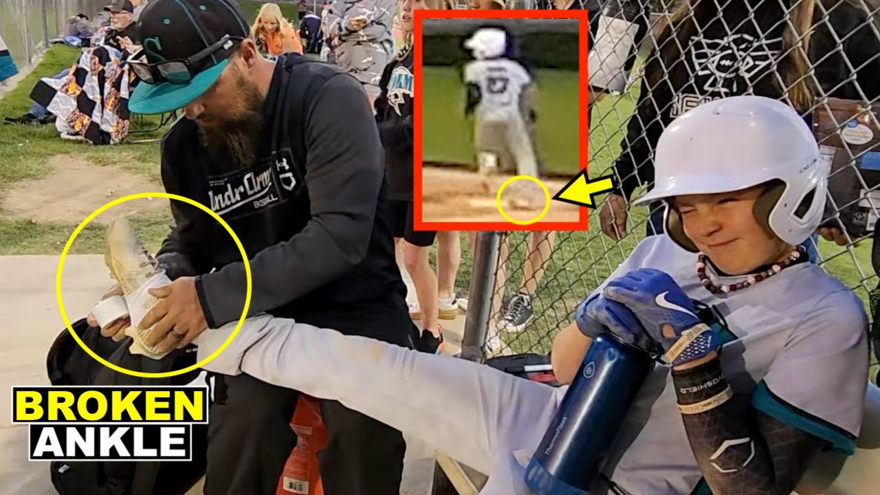 BROKEN ANKLE STEPPING ON FIRST BASE AT BASEBALL TOURNAMENT! ⚾️😱
