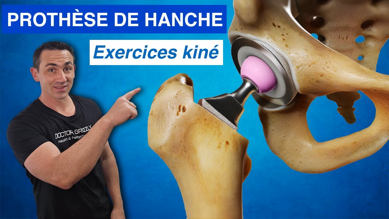 PROTHÈSE DE HANCHE : Rééducation et exercices kiné