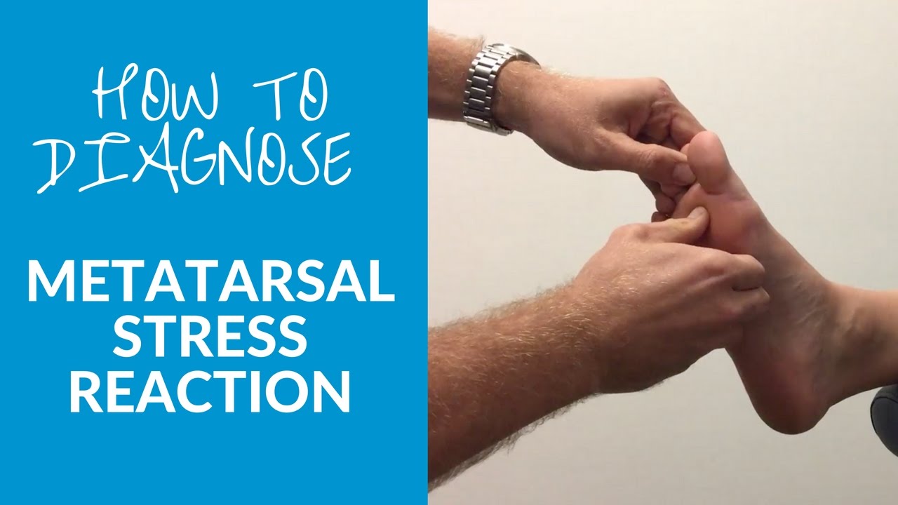 How to diagnose metatarsal stress reaction and fracture