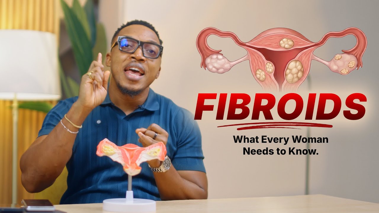 This is what causes fibroids! 