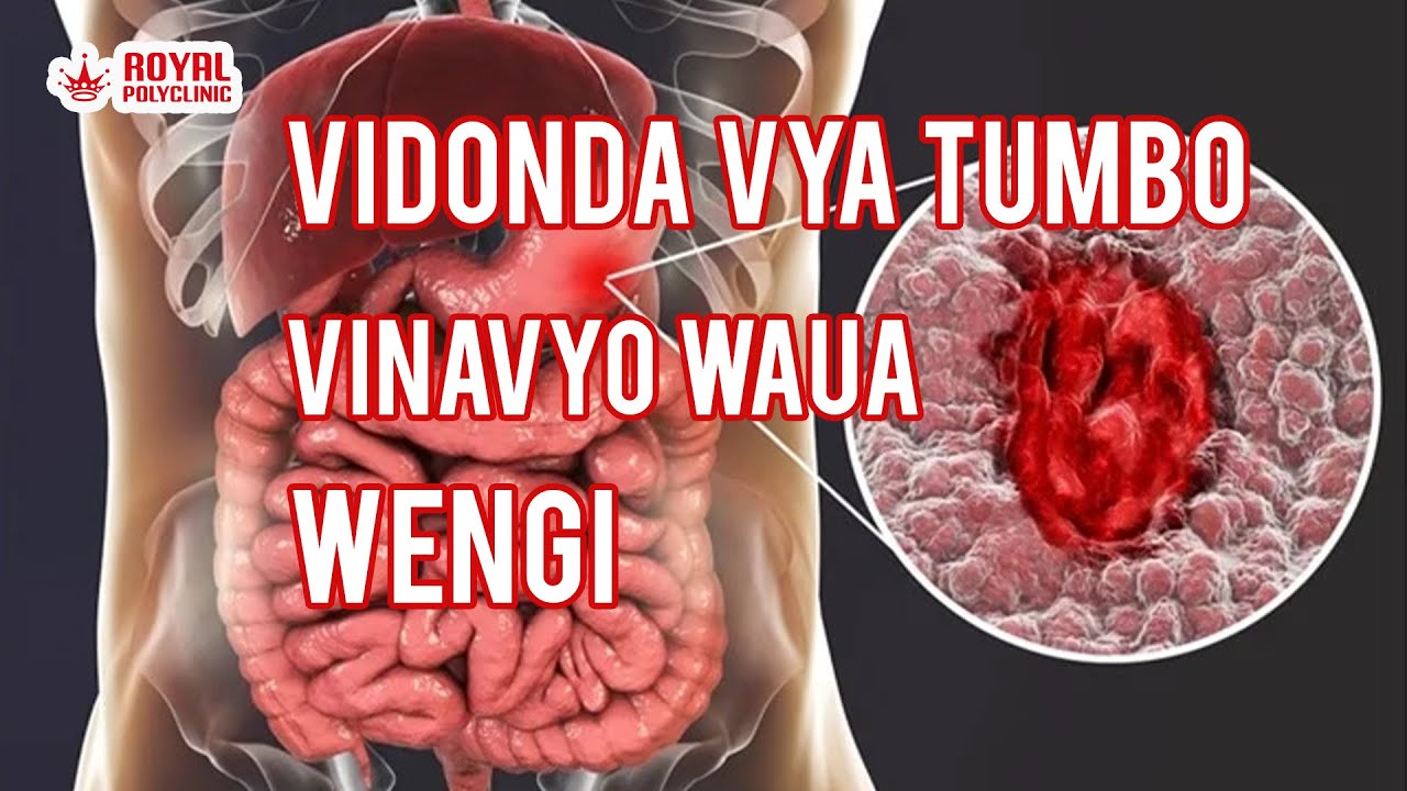 USIPUUZE MAUMIVU YA TUMBO: DALILI NDOGO, MADHARA MAKUBWA