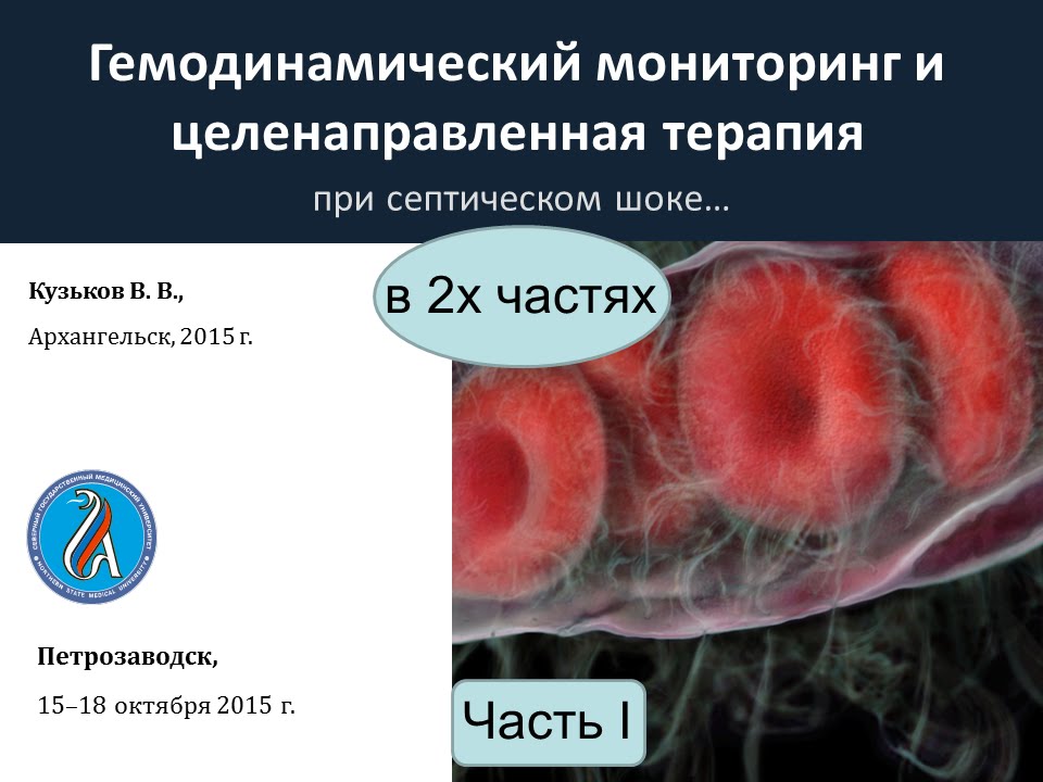 мониторинг гемодинамики Кузьков (ч1)