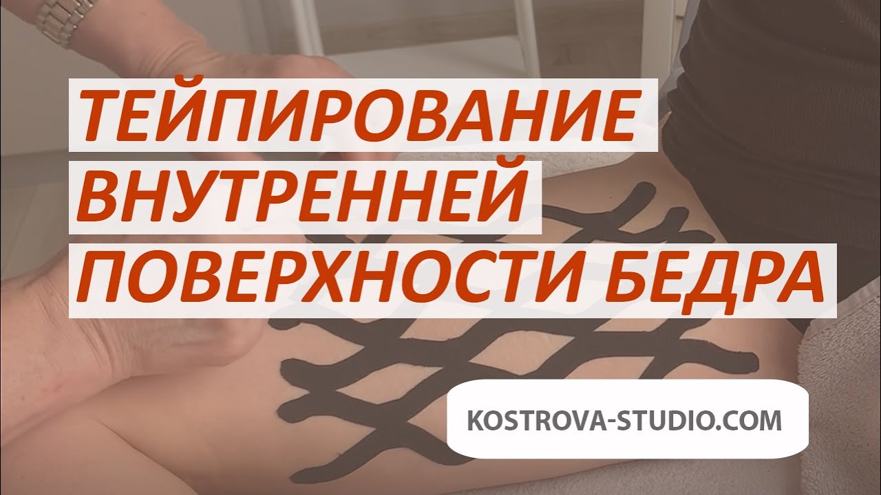 Тейпирование внутренней поверхности бедра