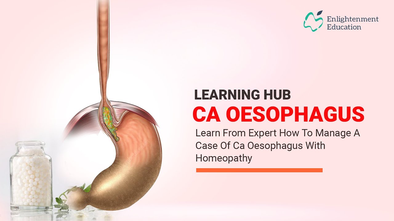 Learning Hub || Case Study - 03 || Case of Carcinoma of Oesophagus & Homeopathic Remedy Lycopodium