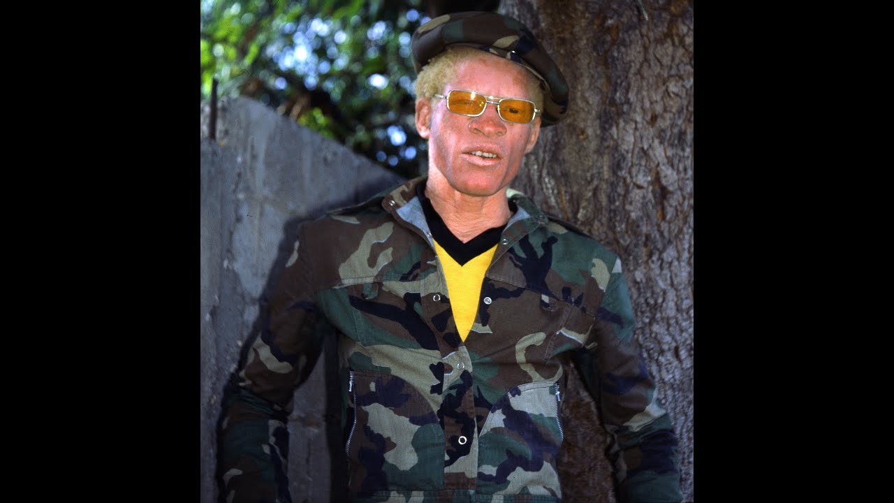 Yellowman at Reggae Sunsplash 1988