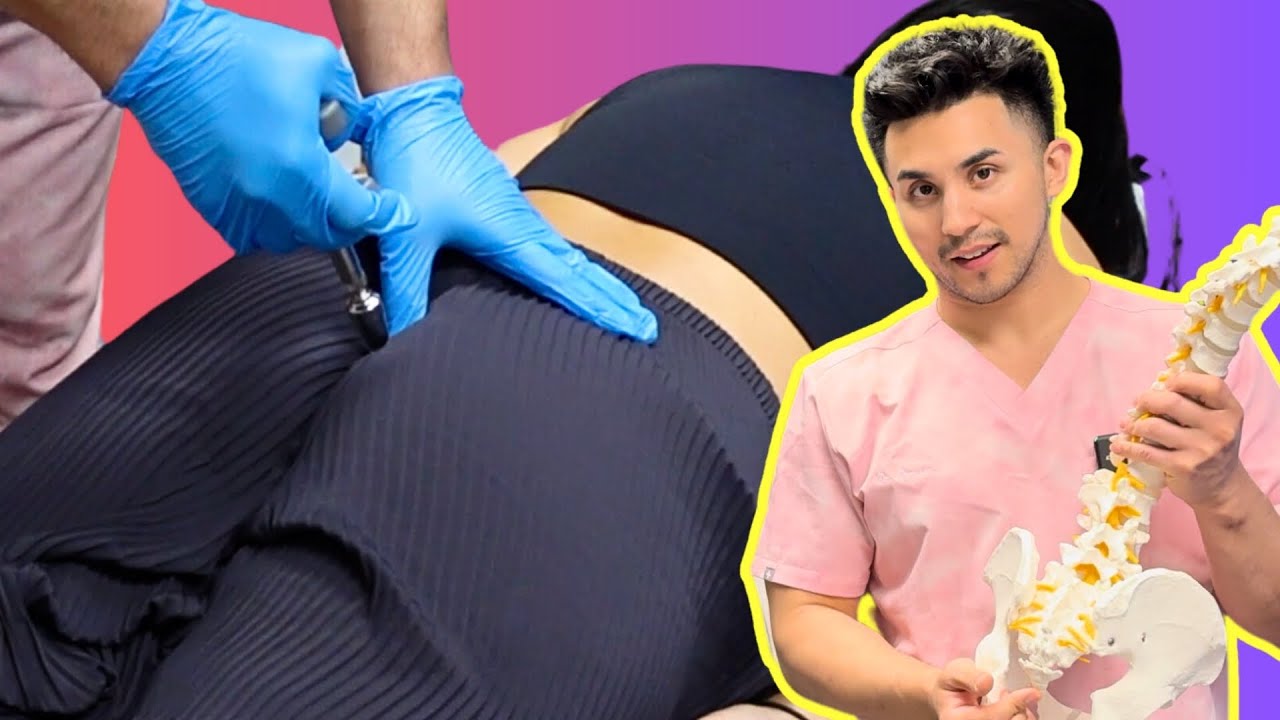 Коррекция смещения копчика (копчика) после несчастного случая на сноуборде