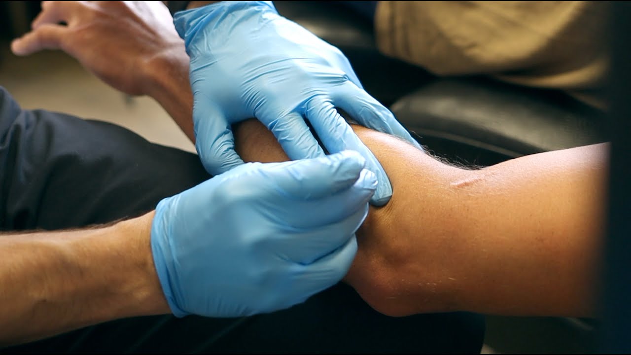 BRACHIORADIALIS TREATMENT WITH DRY-NEEDLING AND BFR