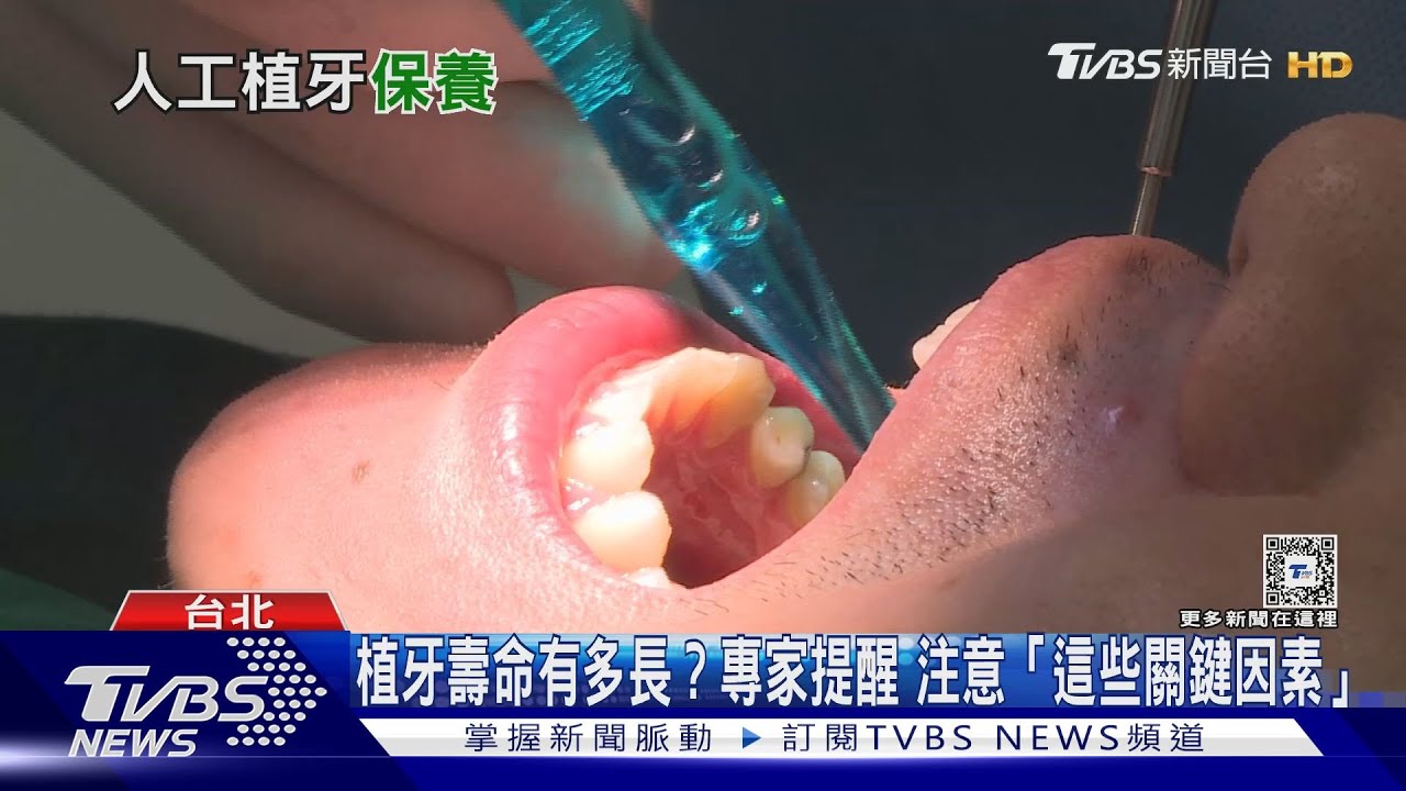 植牙不再是惡夢! 專家給攻略:先治療牙周病...再進行人工植牙｜十點不一樣20240604@TVBSNEWS01