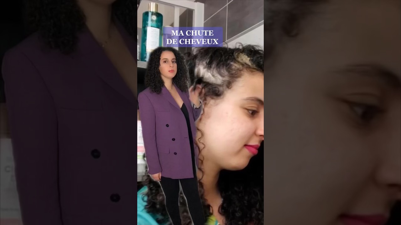 CHUTE DES CHEVEUX MON EXP&Eacute;RIENCE