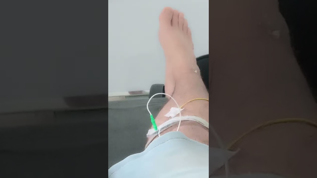 Exame de Eletroneuromiografia realizado por Neurologista.