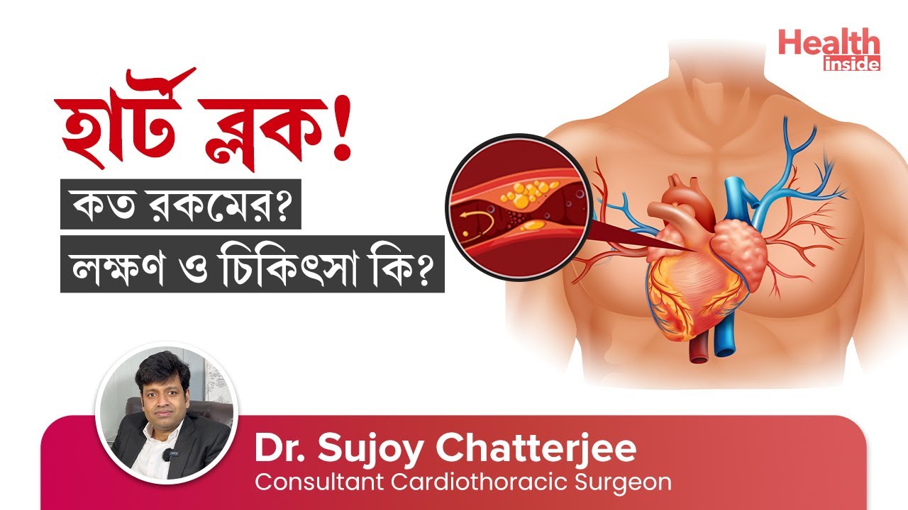 হার্ট ব্লক কি? হার্ট ব্লকের কারণ, লক্ষণ ও চিকিৎসা | Heart Block - Causes, Symptoms & Treatment