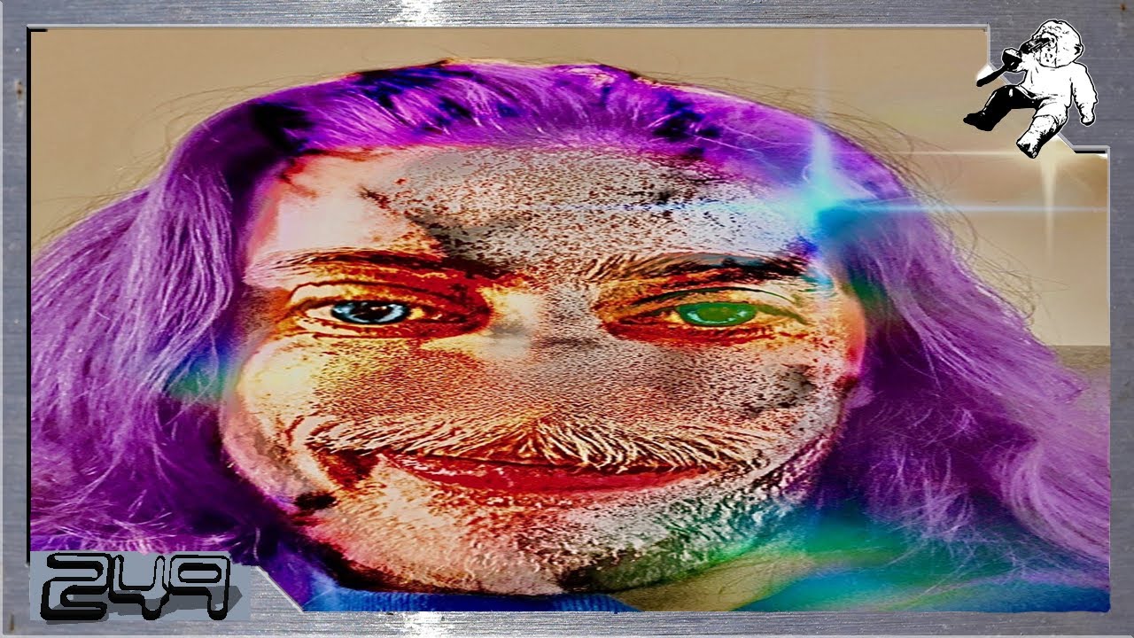 Oh Shoot, He Anjured