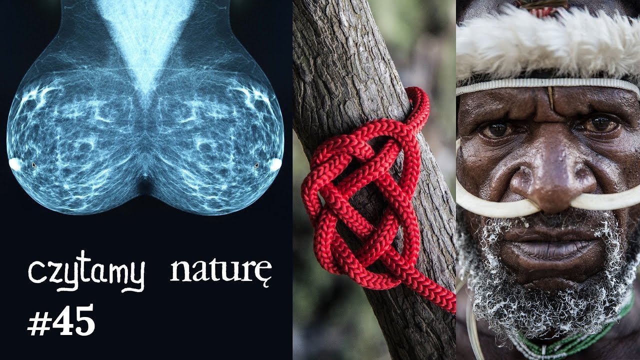 Czytamy naturę #45 | Rak piersi pod okiem AI - Solidne węzły - Gniew Polaka i gniew Papuasa