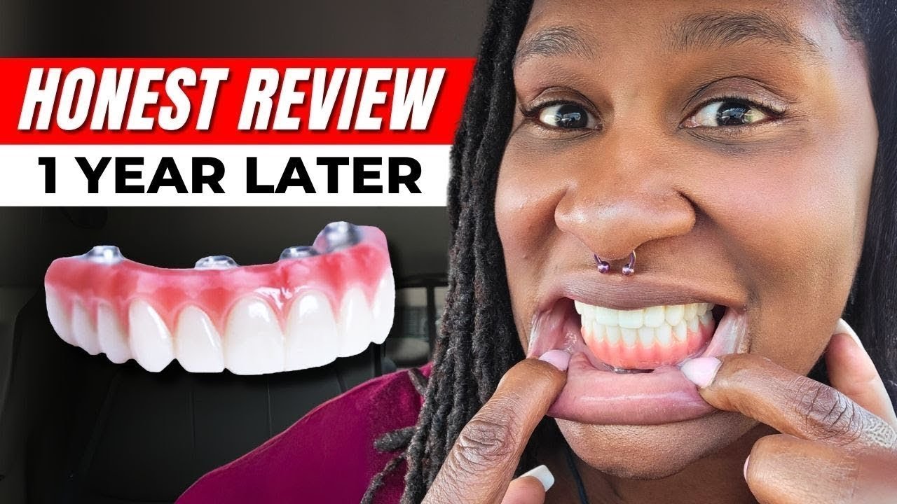 Are My Dental Implants Still Worth It After 1 Year? My Pros & Cons