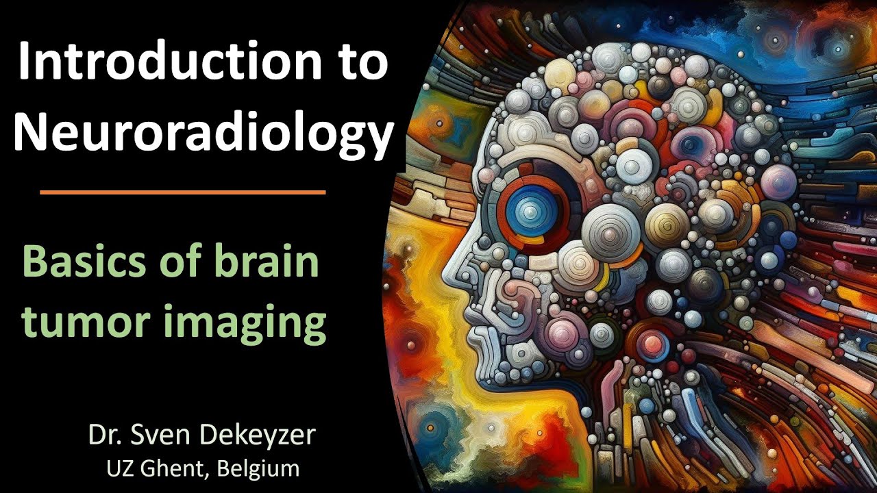 Radiology of Brain Tumors: the basics