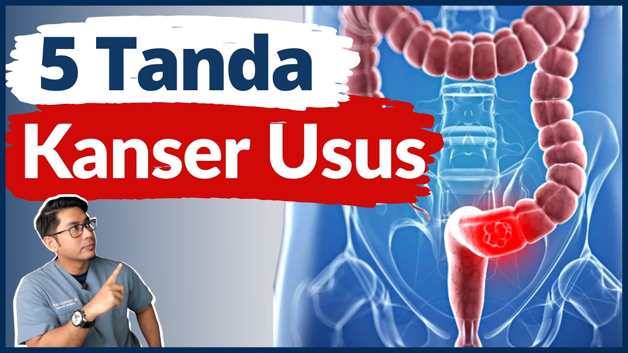 Kerap Sembelit | Kenali 5 Tanda Awal Kanser Usus | Doctor Sani |