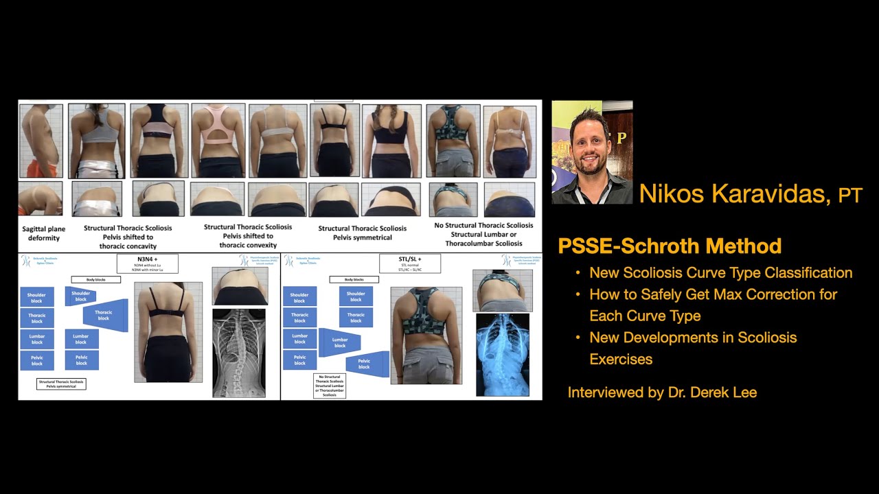 Nikos Karavidas, PT, PSSE-Schroth Method, How to Safely Get Max Correction for Scoliosis Curve Types