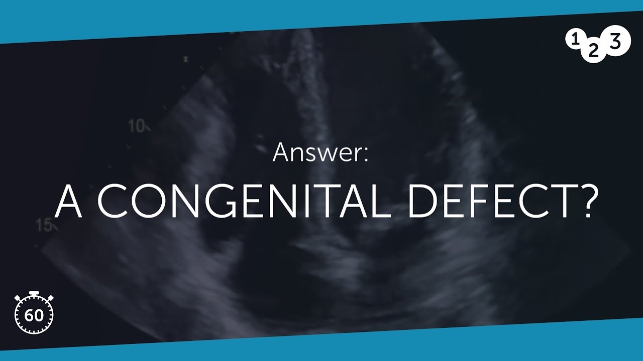 60 Seconds of Echo Teaching Answer: A congenital defect?