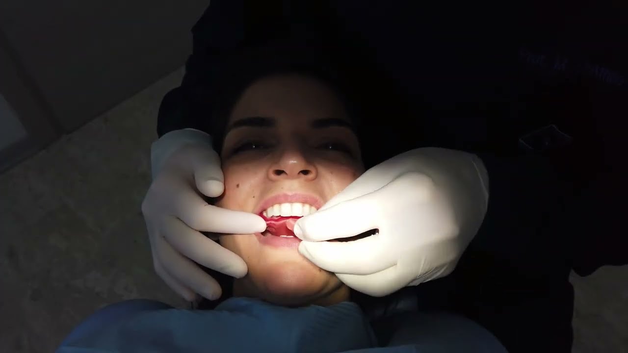 Il Prof. Michele D'Attilio spiega... come si conduce una visita gnatologica