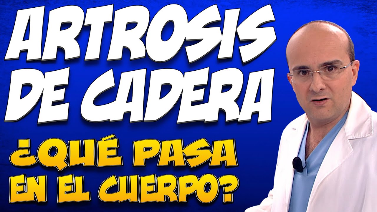 ARTROSIS DE CADERA - &iquest;Qu&eacute; pasa en el cuerpo de quienes la padecen?