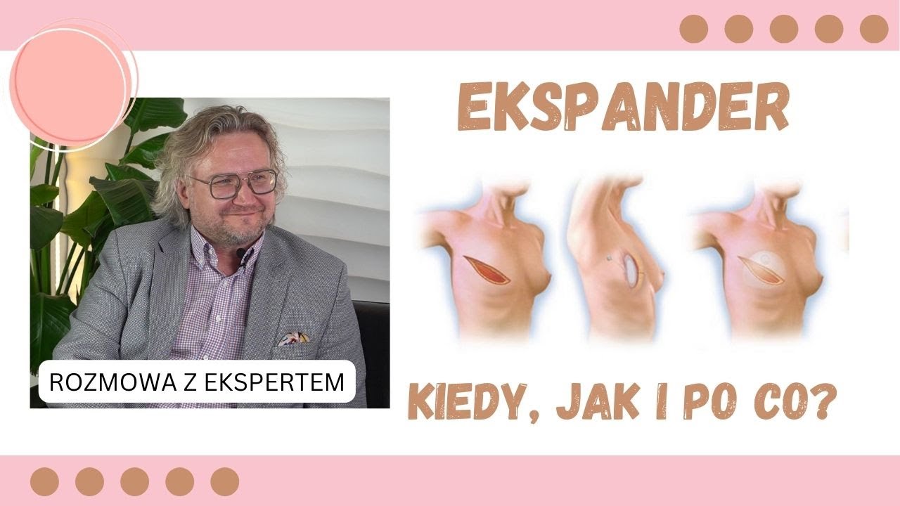 Odcinek 107. Rekonstrukcja piersi z użyciem ekspandera
