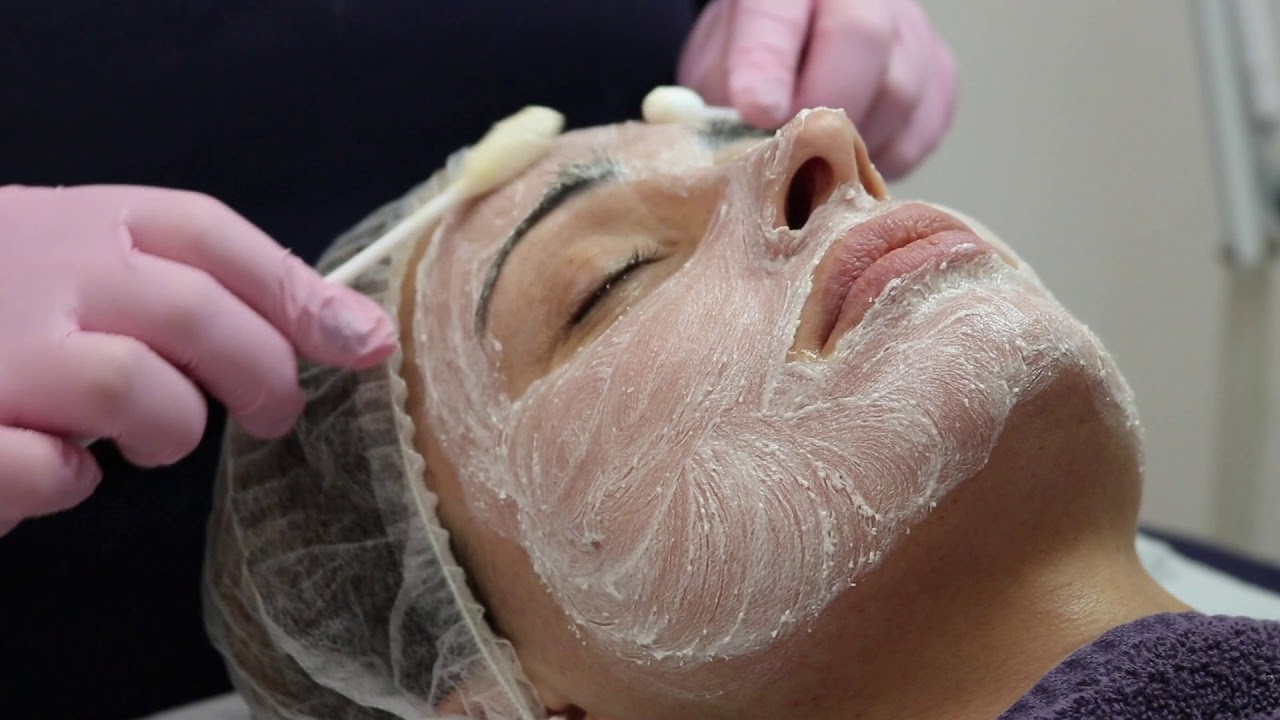 Image Facial Peel | Skin Peels Dublin