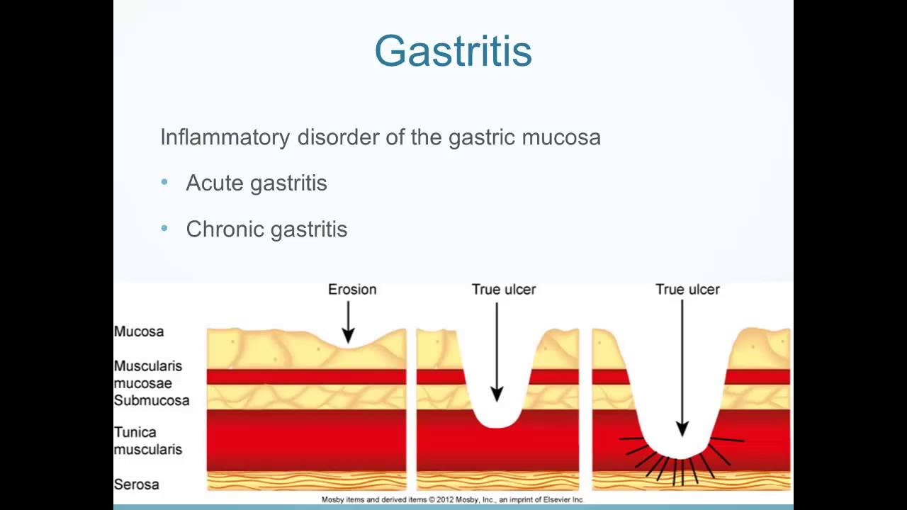 Alterations in Digestive Function