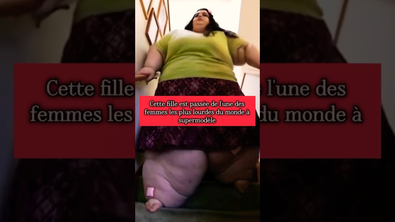 De 300 kg &agrave; supermodel : l&rsquo;incroyable transformation d&rsquo;Amber Rachdi #histoire  #transformation