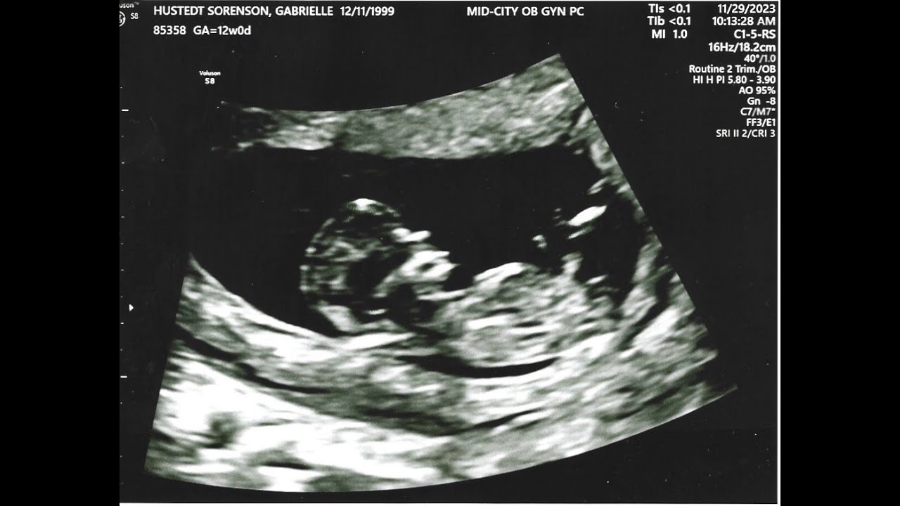 Another big announcement(: