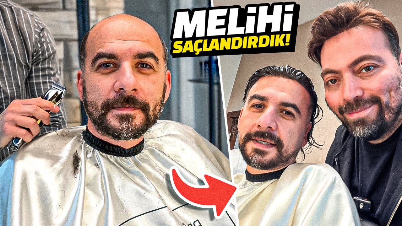 MELİH'E PROTEZ SAÇ YAPTIK! @Melih Abuaf