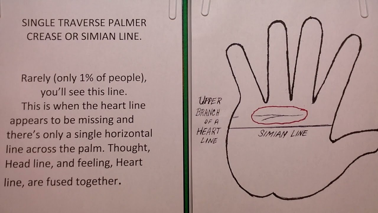 227 THE SINGLE TRAVERSE PALMAR CREASE or SIMIAN LINE