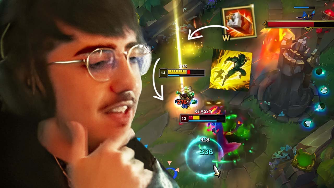 🔝 HIGH LEVEL ZIGGS GAMEPLAY 🔝