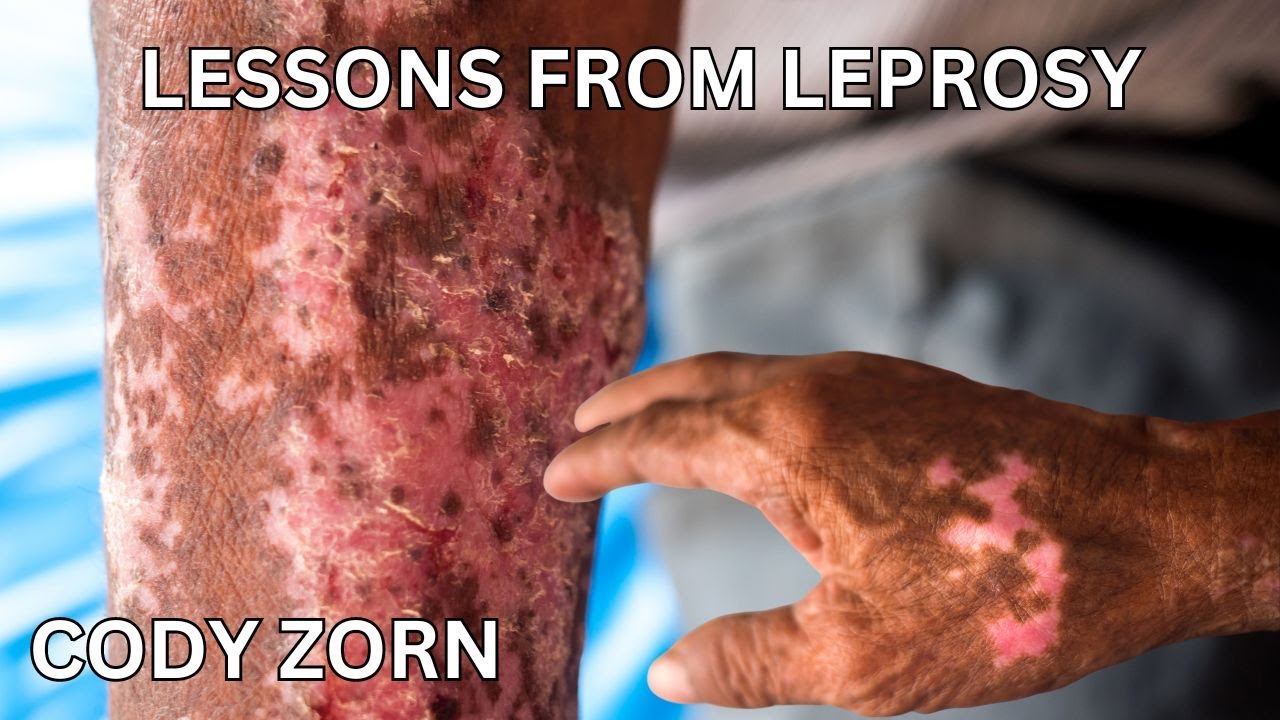 CODY ZORN -  LESSONS FROM LEPROSY
