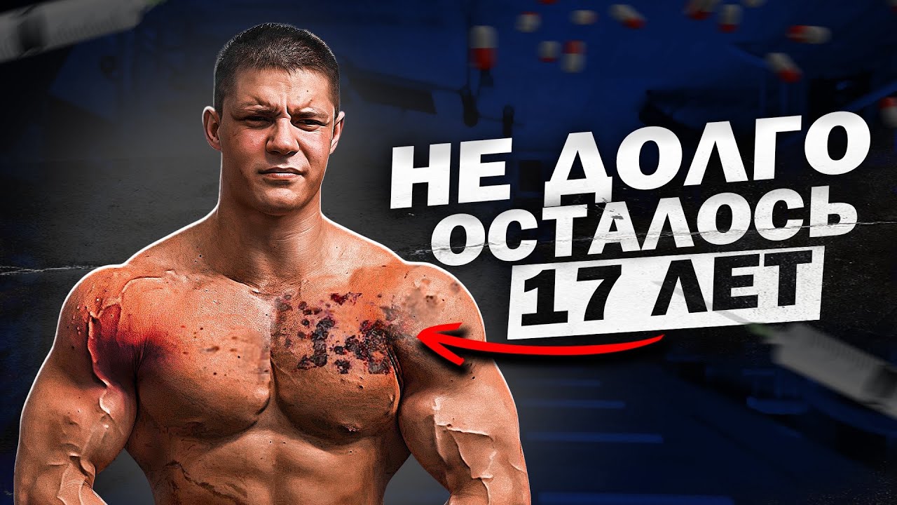 сгнил на химии в 17 лет, малолетний кидала габарц