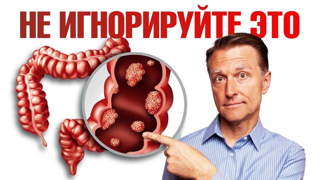 6 ранних признаков рака толстой кишки. НЕ ПРОПУСТИ🧐