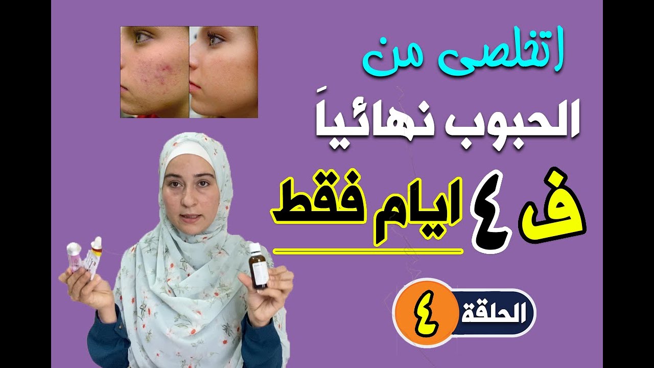 ازاي اتخلص من الحبوب نهائياً في  ٤ ايام فقط | سلسلة روتين العناية بالبشرة | الحلقة الرابعه