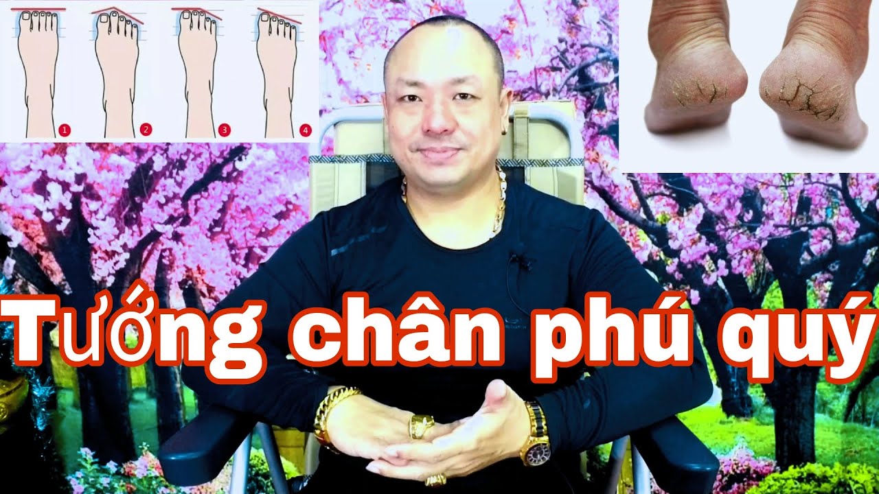 Tướng bàn chân của người sung sướng