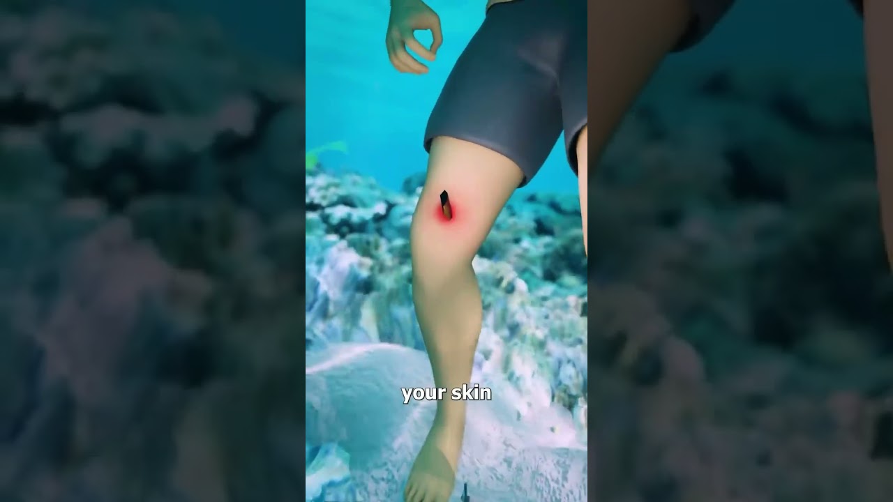 How Stingrays Actually Sting You 😳