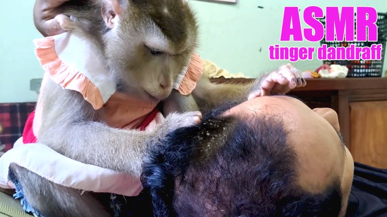 PURE ASMR Hair Dandraff | Great Talent LYLY Start Again Grooming Kindness