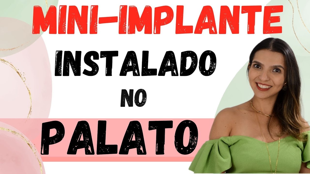 Mini-implante instalado no Palato