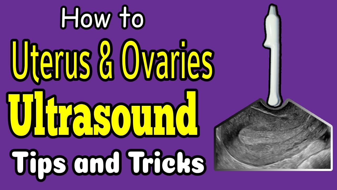 Sonographic Anatomy of the Uterus and Ovaries