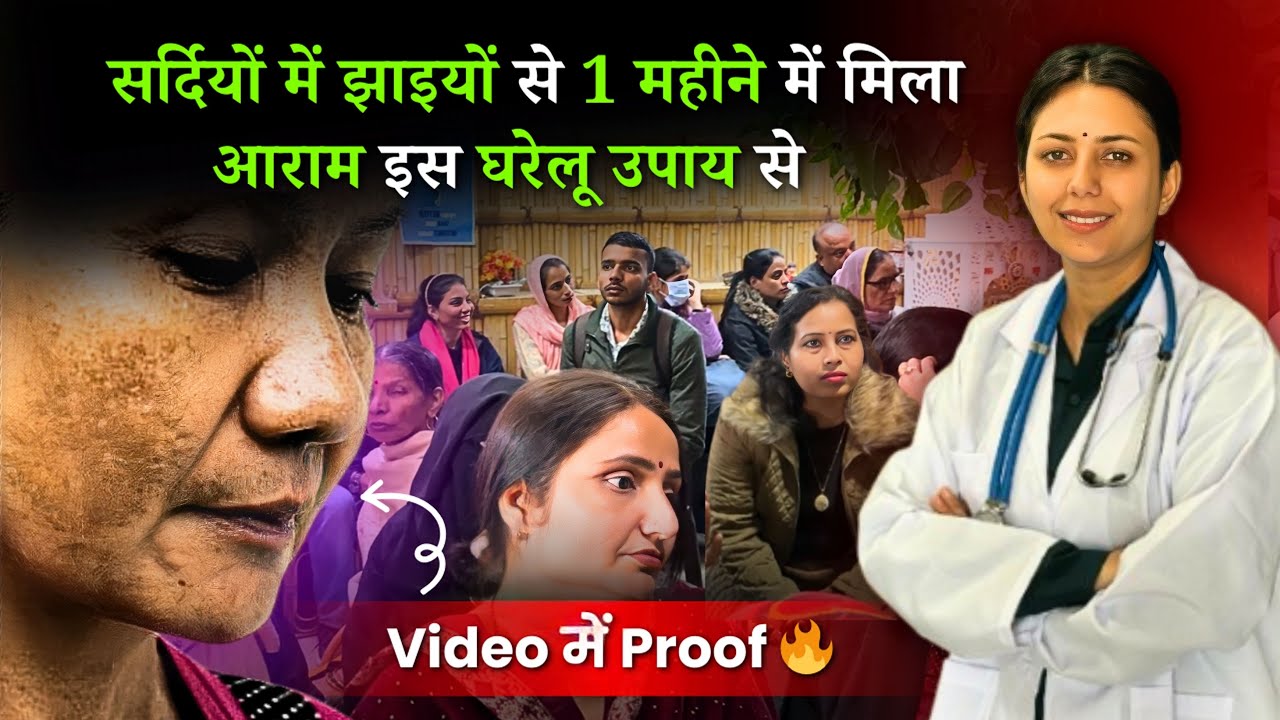 सर्दियों में झाइयों को ठीक किया इस घरेलू उपाय से | Melasma Treatment | Upasana Ki Duniya